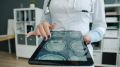 Médico analisando uma Ressonância Magnética do Crânio