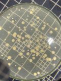 Bactéria Pseudomonas fluorescens